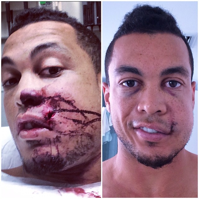 Giancarlo Stanton posts pictures of facial injuries online